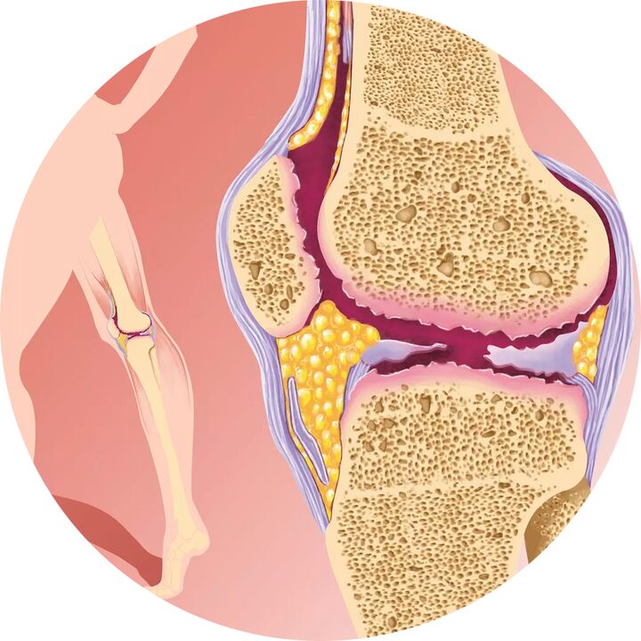 Hondroten - Supporta la mobilità articolare